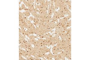 (ABIN6244226 and ABIN6577745) staining WDR82 in human brain tissue sections by Immunohistochemistry (IHC-P - paraformaldehyde-fixed, paraffin-embedded sections). (WDR82 anticorps  (N-Term))