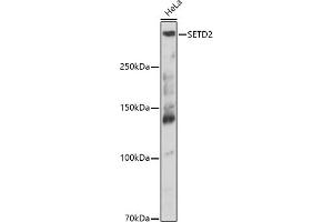 Western blot analysis of extracts of Mouse spleen, using SETD2 antibody (ABIN3017564, ABIN3017565, ABIN1682666 and ABIN6220156) at 1:913 dilution.