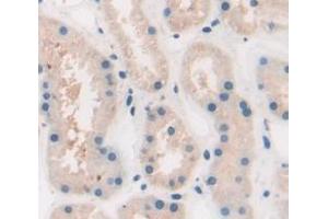 IHC-P analysis of Human Tissue, with DAB staining. (AGRP anticorps  (AA 20-130))