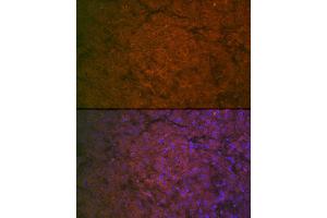Immunofluorescence analysis of human liver cells using Factor IX / F9 Rabbit pAb (ABIN3022173, ABIN3022174, ABIN3022175, ABIN1512886 and ABIN6218646) at dilution of 1:100 (40x lens).