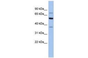 Image no. 1 for anti-Glycyl-tRNA Synthetase (GARS) (AA 575-624) antibody (ABIN6744313) (GARS anticorps  (AA 575-624))