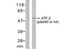 Western Blotting (WB) image for anti-Activating Transcription Factor 2 (ATF2) (pSer62) antibody (ABIN2888361) (ATF2 anticorps  (pSer62))