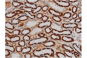 ABIN6267399 at 1/200 staining Rat kidney tissue sections by IHC-P. (CREB1 anticorps  (pSer142))