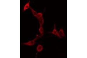 ABIN6275911 staining  HeLa cells by IF/ICC. (Serotonin Receptor 5A anticorps  (Internal Region))