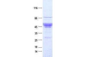 Validation with Western Blot (NPTX2 Protein (DYKDDDDK Tag))