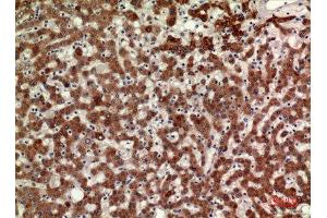 Immunohistochemistry (IHC) analysis of paraffin-embedded Human Liver, antibody was diluted at 1:100. (MPL anticorps  (Internal Region))