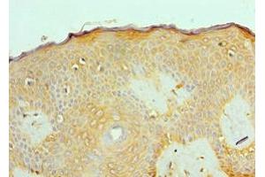 Immunohistochemistry of paraffin-embedded human skin tissue using ABIN7143180 at dilution of 1:100 (ACVR2A anticorps  (AA 20-140))