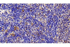 Detection of S100A12 in Porcine Lymph node Tissue using Polyclonal Antibody to S100 Calcium Binding Protein A12 (S100A12)