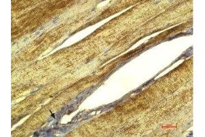 Expression of CaVγ1 (CACNG1) in rat skeletal muscle - Immunohistochemical staining of paraffin-embedded rat skeletal muscle sections using Anti-CACNG1 (extracellular) Antibody (ABIN7042988, ABIN7044053 and ABIN7044054), (1:100), followed by DAB.