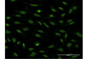 Immunofluorescence of monoclonal antibody to OXSR1 on HeLa cell. (OXSR1 anticorps  (AA 351-450))
