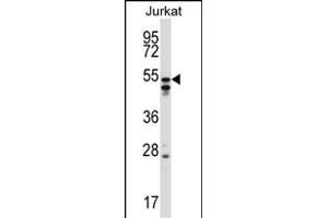 HNRNPH2 Antibody (C-term) (ABIN657420 and ABIN2846457) western blot analysis in Jurkat cell line lysates (35 μg/lane). (HNRNPH2 anticorps  (C-Term))