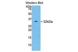 Western Blotting (WB) image for anti-Serpin Family A Member 7 (SERPINA7) (AA 127-393) antibody (ABIN1078580) (SERPINA7 anticorps  (AA 127-393))