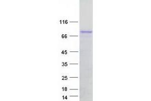 Validation with Western Blot