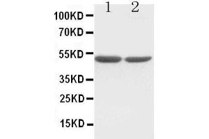 Anti-c-Fos antibody, Western blotting Lane 1:  Cell Lysate Lane 2: COLO320 Cell Lysate