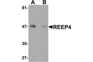 Western blot analysis of REEP4 in human lung tissue lysate with REEP4 antibody at 1 μg/ml in (A) the absence and (B) the presence of blocking peptide.