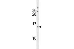 LIMS3L / LIMS3 antibody western blot analysis in 293 lysate. (LIMS3 anticorps  (AA 28-54))
