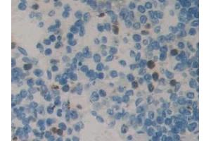 anti-NME/NM23 Family Member 5 (NME5) (AA 16-210) antibody