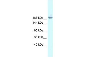 WB Suggested Anti-SNRNP200 Antibody Titration: 1.