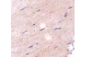 Immunohistochemical staining of mouse skeletal muscle tissue with 5 ug/mL FNIP2 polyclonal antibody .