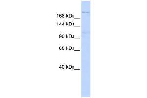 WB Suggested Anti-INADL Antibody Titration:  0. (PATJ anticorps  (N-Term))