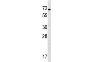 NOX1 antibody western blot analysis in WiDr lysate.