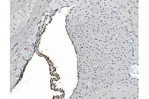 IHC analysis of GRX2/GLRX2 using anti-GRX2/GLRX2 antibody (ABIN7599022). (Glutaredoxin 2 anticorps  (AA 1-164))