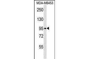 Western blot analysis in MDA-MB453 cell line lysates (35ug/lane). (FBXO11 anticorps  (N-Term))