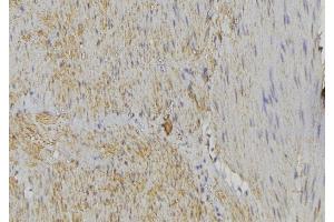 ABIN6274612 at 1/100 staining Mouse muscle tissue by IHC-P. (HCCS anticorps  (Internal Region))