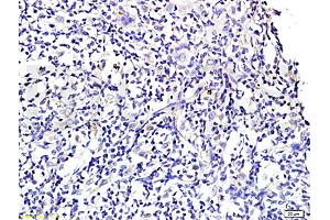 Formalin-fixed and paraffin embedded rat periodontitis tissue labeled with Anti-Wnt3a Polyclonal Antibody , Unconjugated at 1:300 followed by conjugation to the secondary antibody, (SP-0023) , and DAB staining (WNT3A anticorps  (AA 281-352))