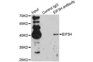 Immunofluorescence analysis of MCF7 cells using EIF3H antibody.