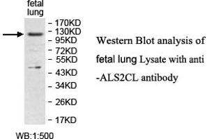 Image no. 1 for anti-ALS2 C-terminal Like (ALS2CL) antibody (ABIN1574646)