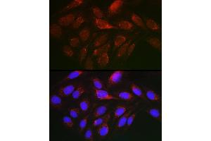 anti-Cytochrome C, Somatic (CYCS) (AA 1-105) antibody