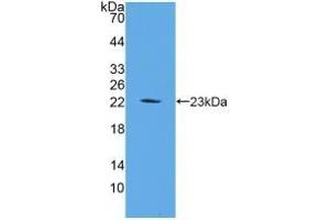 Detection of Recombinant FGF6, Mouse using Polyclonal Antibody to Fibroblast Growth Factor 6 (FGF6) (FGF6 anticorps  (AA 39-208))