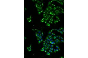 Immunofluorescence analysis of U2OS cells using TSHB antibody (ABIN6132751, ABIN6149620, ABIN6149621 and ABIN6222522).
