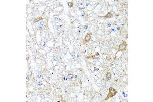 Immunohistochemistry of paraffin-embedded rat brain using SERPINA7 antibody (ABIN5975019) at dilution of 1/100 (40x lens). (SERPINA7 anticorps)