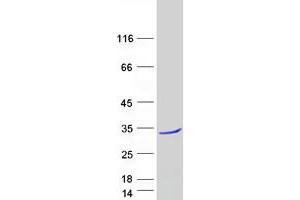 Validation with Western Blot