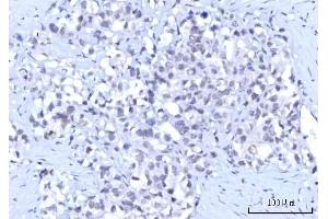 IHC analysis of RBM15B using anti-RBM15B antibody (ABIN7600219). (RBM15B anticorps  (AA 164-890))
