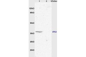 Lane 1: mouse brain lysates Lane 2: mouse embryo lysates probed with Anti GPR55 Polyclonal Antibody, Unconjugated  at 1:200 in 4˚C. (GPR55 anticorps  (AA 141-240))