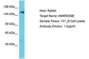 Image no. 1 for anti-Ankyrin Repeat Domain 36B (ANKRD36B) (AA 1263-1312) antibody (ABIN6750651) (ANKRD36B anticorps  (AA 1263-1312))