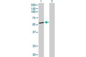 Western Blot analysis of CYP2C8 expression in transfected 293T cell line by CYP2C8 MaxPab polyclonal antibody.