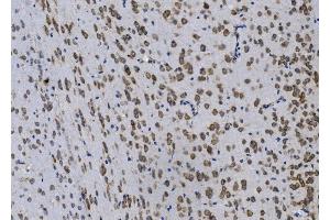 IHC analysis of Gpnmb using anti-Gpnmb antibody (ABIN7600217). (Osteoactivin anticorps  (AA 164-564))