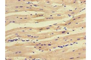 Immunohistochemistry of paraffin-embedded human heart tissue using ABIN7166097 at dilution of 1:100 (SCO1 anticorps  (AA 29-176))