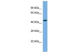 Host:  Rabbit  Target Name:  TBC1D22A  Sample Type:  NCI-H226 Whole cell lysates  Antibody Dilution:  1. (TBC1D22A anticorps  (Middle Region))