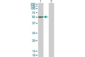 Western Blot analysis of ALDH1A1 expression in transfected 293T cell line by ALDH1A1 MaxPab polyclonal antibody. (ALDH1A1 anticorps  (AA 1-501))