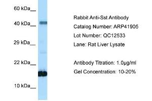 Host: Rabbit Target Name: SST Sample Tissue: Rat Liver Antibody Dilution: 1ug/ml (Somatostatin anticorps  (N-Term))