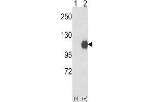 Western Blotting (WB) image for anti-Ectonucleotide Pyrophosphatase/phosphodiesterase 2 (ENPP2) antibody (ABIN2927789) (ENPP2 anticorps)