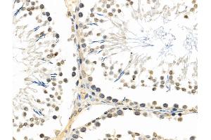 ABIN6257778 and ABIN6274220 at 1/100 staining Rat testis tissue by IHC-P.