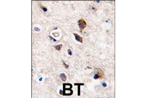 Formalin-fixed and paraffin-embedded human brain tissue reacted with PKC gamma antibody , which was peroxidase-conjugated to the secondary antibody, followed by DAB staining. (PKC gamma anticorps  (C-Term))