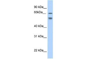 Western Blot showing RBM35B antibody used at a concentration of 1-2 ug/ml to detect its target protein. (ESRP2 anticorps  (N-Term))