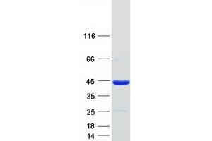 Validation with Western Blot